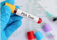 PSA Test